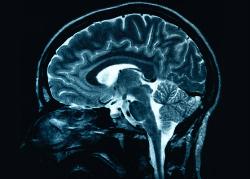 111007brain01.JPG