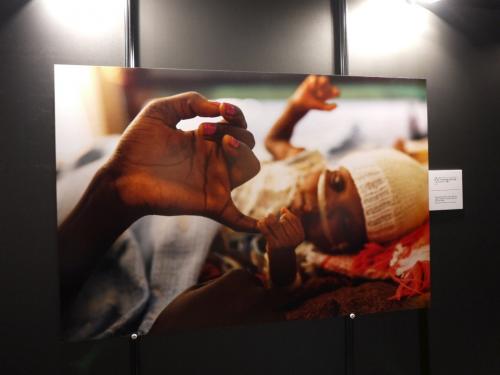 救いを求める人々への非情な暴力……頻発する病院攻撃を写真展で告発