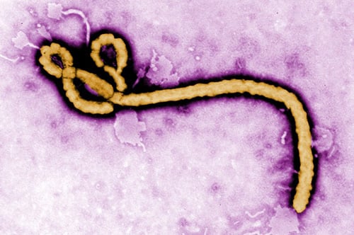 エボラウイルスが恐ろしい理由（Medエッジ）