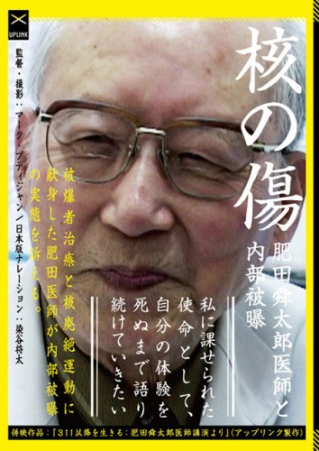 核の傷：肥田舜太郎医師と内部被曝