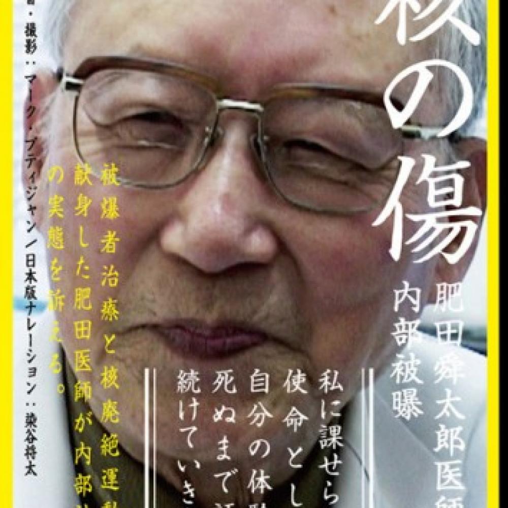 なぜ日本政府は米国政府と結託して嘘をついたのか 映画『核の傷：肥田舜太郎医師と内部被曝』 ｜ ガジェット通信 GetNews