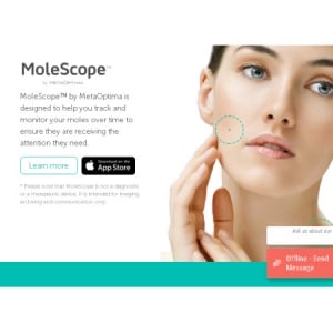 スマホのレンズで皮膚ガンを早期発見!?超精細画像が可能な「Molescope」