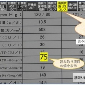 「かざして OCR 2.0」がリリース、健康診断の結果票をスマホカメラで読み取り音声で読み上げ