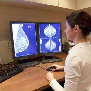 女性に優しい乳がん診断を！Lily MedTech、NEDO-PCAに採択