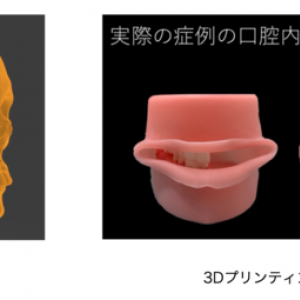 歯科領域で実証実験！ 東京と大阪間で、VR・AR映像を通した若手指導と手術支援