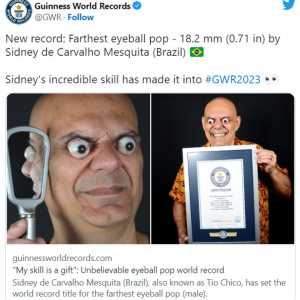 ブラジル在住の男性が「最も遠くに飛び出た眼球」のギネス世界記録に認定される 「実写版ホーマー・シンプソン」「目の手術しなくても大丈夫なのかな」
