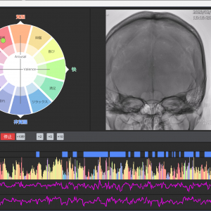 心電センサとAIで手術中の医師の感情を“見える化”。AI感情可視化システムで働き方改革へ