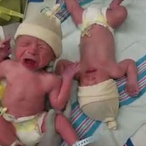 産まれたばかりの双子の赤ちゃん…再び肌が触れあった瞬間に奇跡が起きた！