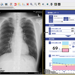 山梨県の企業健診にて、骨評価AIで胸部X線写真から骨粗しょう症の早期発見につなげる実証実験
