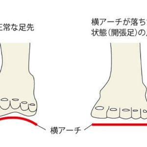 【神奈川県平塚市】開帳足を改善してジョギングを生涯スポーツに。コラル接骨院「市民ランナー駆け込み寺」