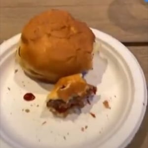 ハンバーガーを食べていたら口内で激痛が･･･口を開けてみると目を疑う事態が起きていた！