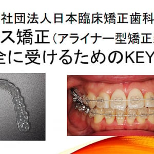 日本臨床矯正歯科医会がマウスピース矯正（アライナー矯正）治療で知っておくべき5つのポイントを伝授　トラブルを未然に防ぐべく、まずは認定医に相談を