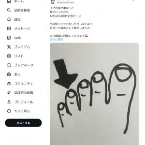 山寺宏一さん「この指がポキっと 角でいったから 12月6日は骨折記念日」Twitter(X)で「自分への戒めとして制定しました」