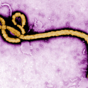 エボラウイルスが恐ろしい理由　西アフリカでのエボラ出血熱流行を受けて　西川伸一 THE CLUB（Medエッジ）